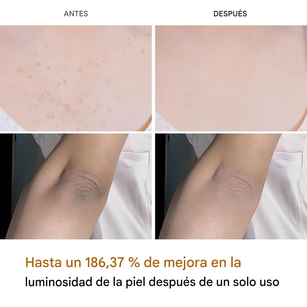 DR. MELAXIN PEEL SHOT™ - Para Aclarear Partes Oscuras - Fórmula Cúrcuma